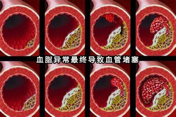 太全了！“三高”人群哪些能吃，哪些不能吃？40岁后人手一份！