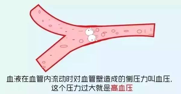 为何“高血压”越来越普遍？跟随李医生：带你全方位了解高血压！
