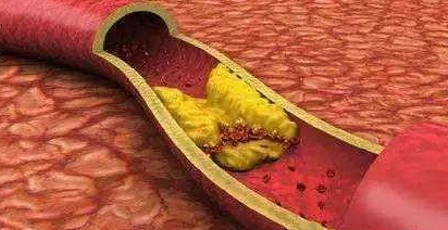 低压高的原因是什么？