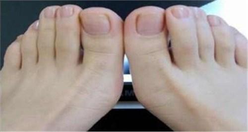 中医发现:不论男女,如果脚上有这个东西,你会长寿到一百多